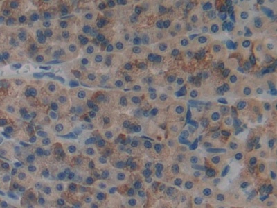 Polyclonal Antibody to Myosin IF (MYO1F)