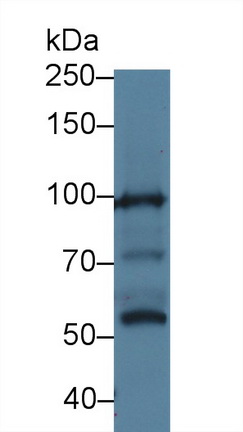 Polyclonal Antibody to Myosin IG (MYO1G)