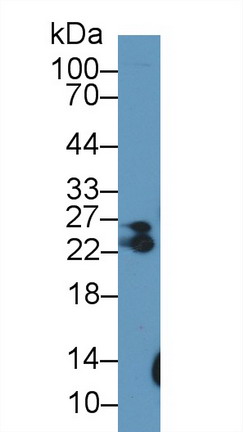 Polyclonal Antibody to Myosin Light Chain 6B, Alkali, Smooth Muscle And Non Muscle (MYL6B)