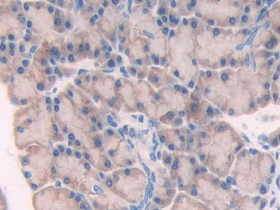 Polyclonal Antibody to Myosin Light Chain 6B, Alkali, Smooth Muscle And Non Muscle (MYL6B)