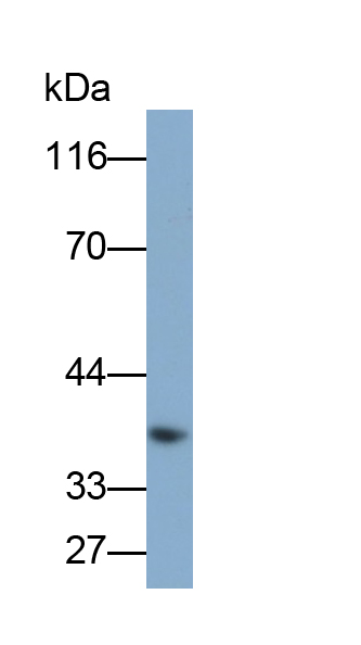 Polyclonal Antibody to Tropomyosin 2 Beta (TPM2)