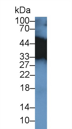 Polyclonal Antibody to Tropomyosin 3 (TPM3)