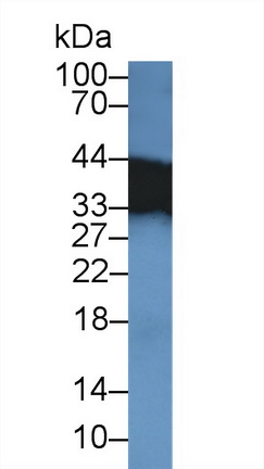 Polyclonal Antibody to Tropomyosin 3 (TPM3)