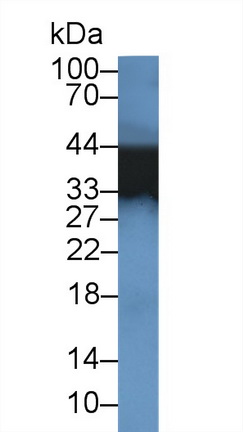 Polyclonal Antibody to Tropomyosin 3 (TPM3)