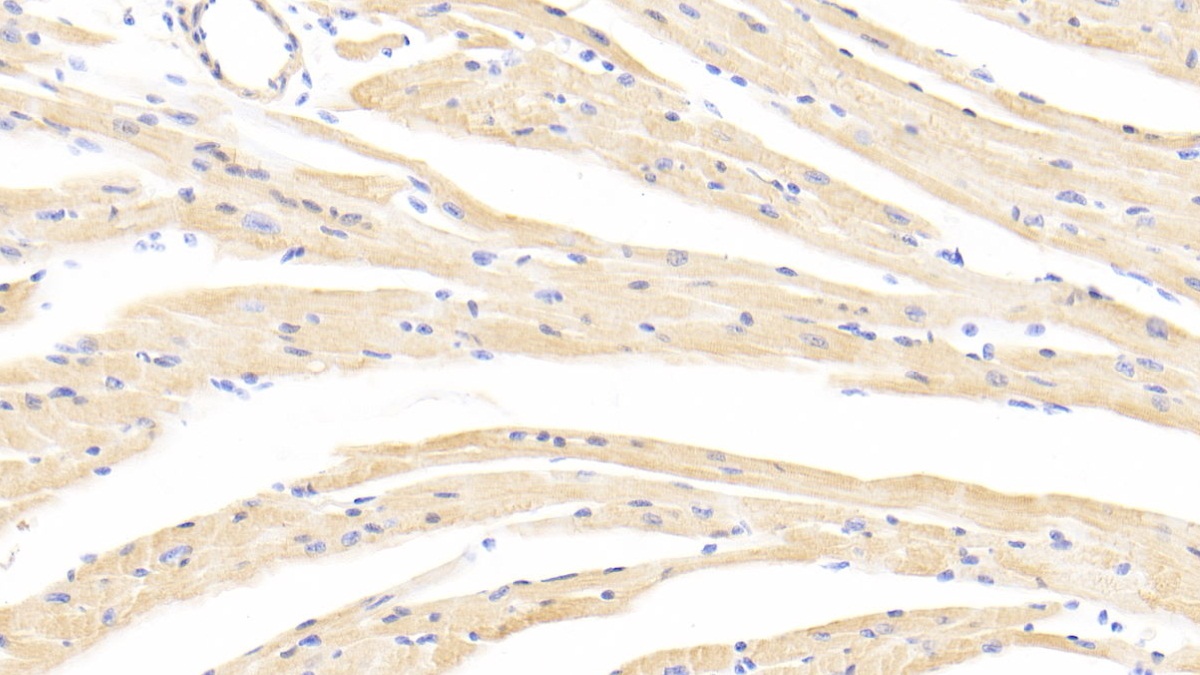 Polyclonal Antibody to Tropomyosin 3 (TPM3)