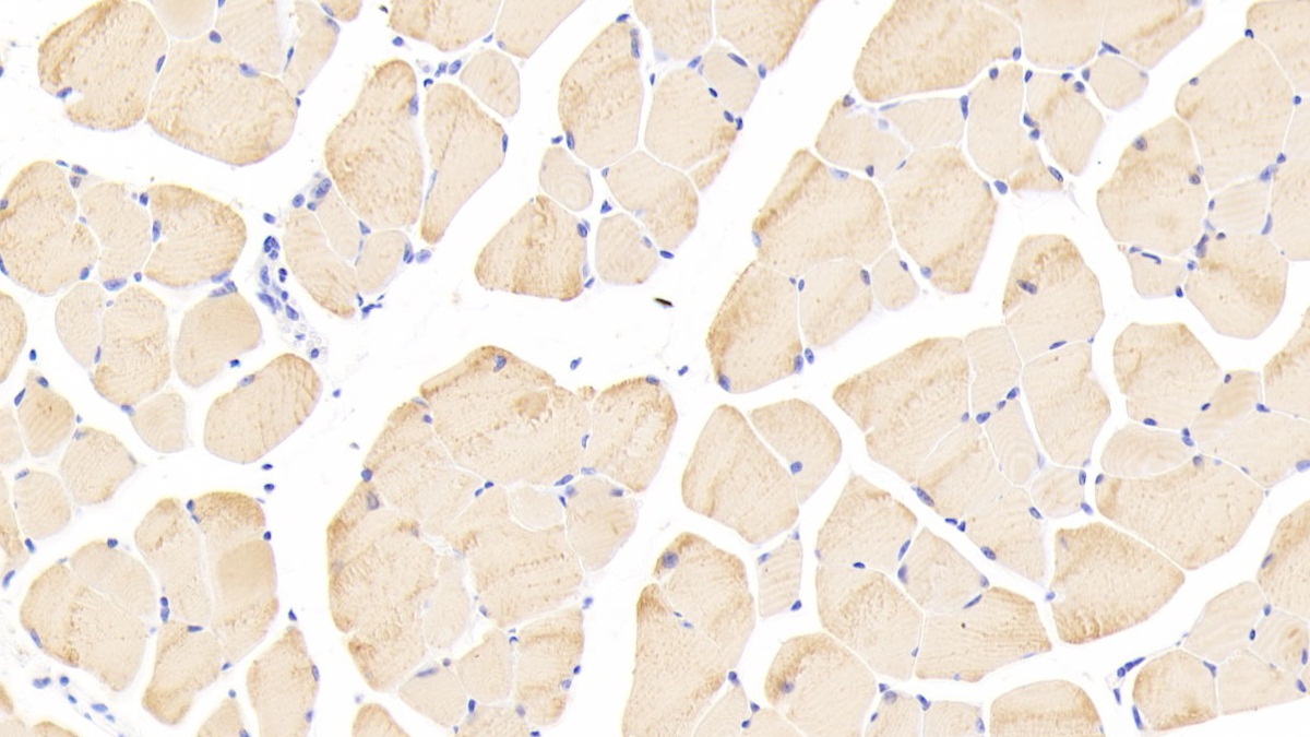 Polyclonal Antibody to Tropomyosin 3 (TPM3)