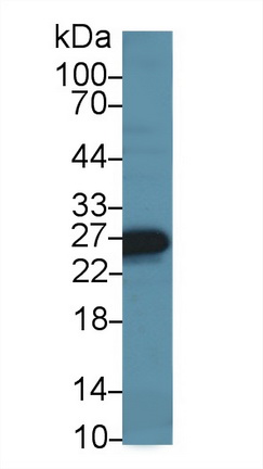 Polyclonal Antibody to Myosin Light Chain 7, Regulatory (MYL7)