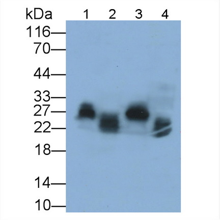 Polyclonal Antibody to Myosin Light Chain 7, Regulatory (MYL7)