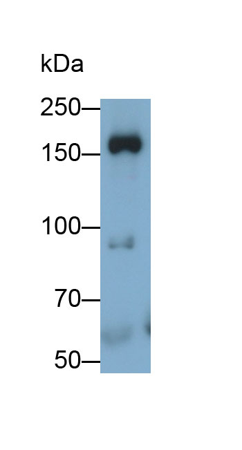 Polyclonal Antibody to Myosin Heavy Chain 14, Non Muscle (MYH14)