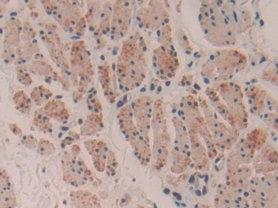 Polyclonal Antibody to Myosin Heavy Chain 16 (MYH16)