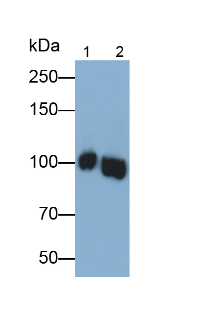 Polyclonal Antibody to Myosin Heavy Chain 16 (MYH16)