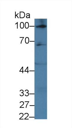 Polyclonal Antibody to Hypoxia Inducible Factor 2 Alpha (HIF2a)