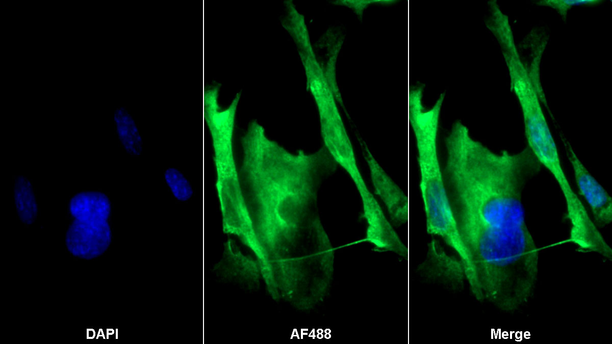 Polyclonal Antibody to Hypoxia Inducible Factor 2 Alpha (HIF2a)