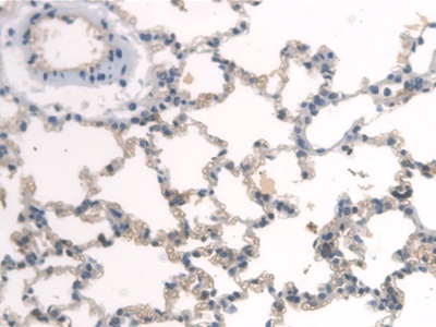 Polyclonal Antibody to Aryl Hydrocarbon Receptor Nuclear Translocator Like Protein (ARNTL)