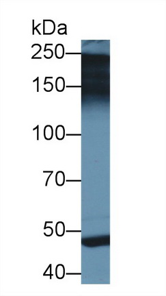 Polyclonal Antibody to Pappalysin 2 (PAPPA2)