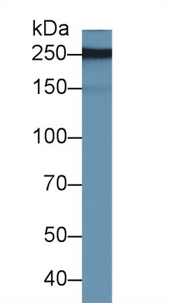 Polyclonal Antibody to Pappalysin 2 (PAPPA2)