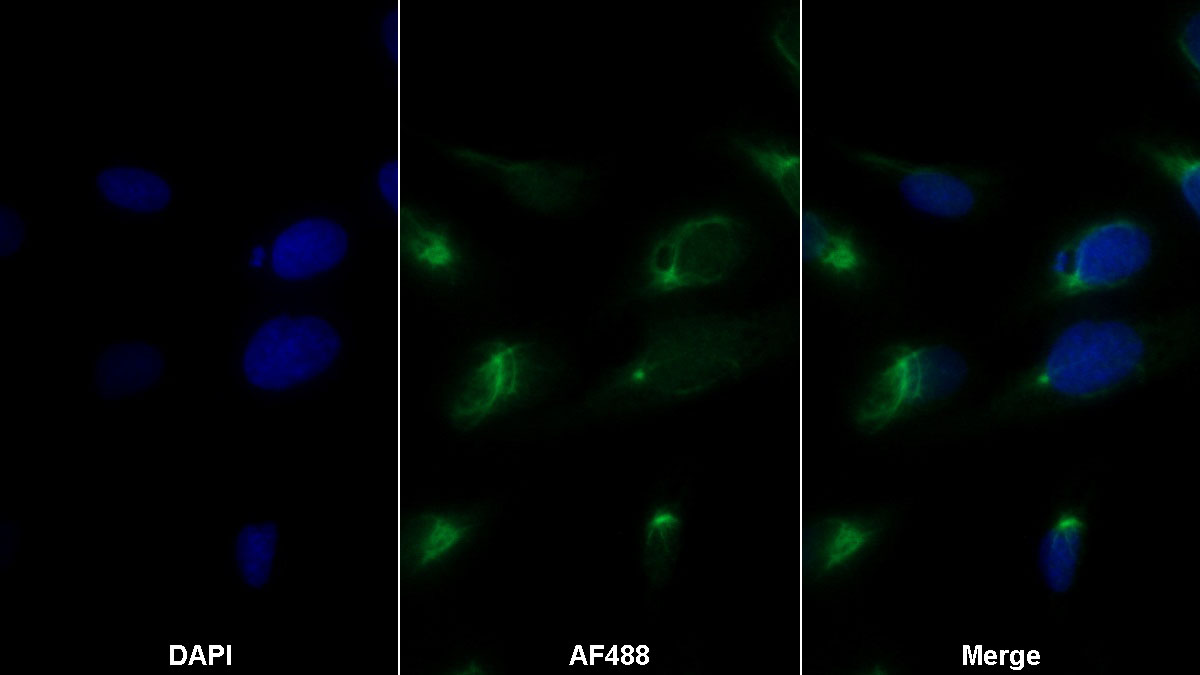 Polyclonal Antibody to Pappalysin 2 (PAPPA2)