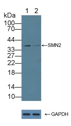 Polyclonal Antibody to Survival Of Motor Neuron 2, Centromeric (SMN2)