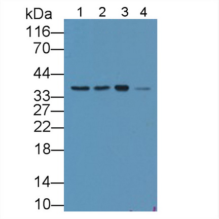 Polyclonal Antibody to Survival Of Motor Neuron 2, Centromeric (SMN2)