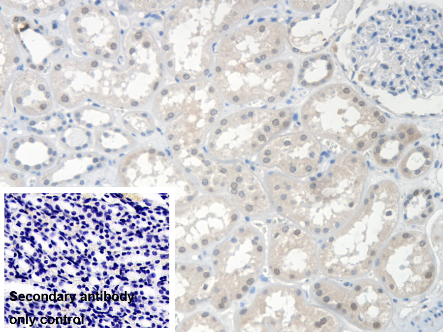 Polyclonal Antibody to Survival Of Motor Neuron 2, Centromeric (SMN2)