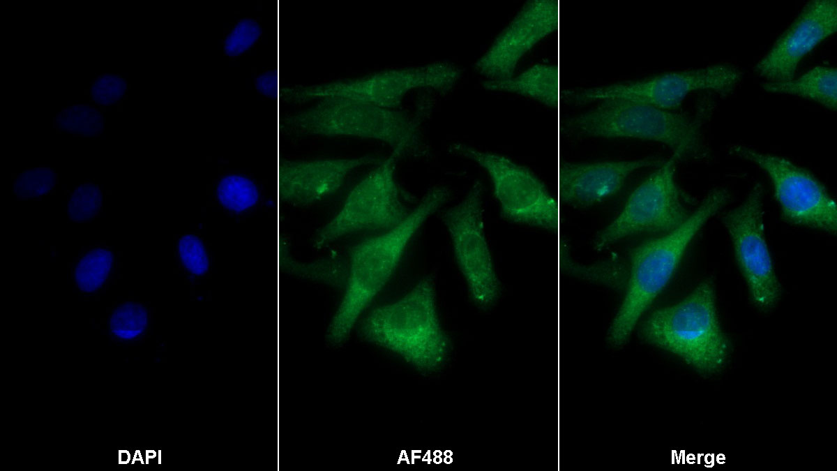 Polyclonal Antibody to Heat Shock Protein Beta 3 (HSPb3)