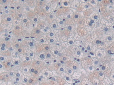 Polyclonal Antibody to Heat Shock Protein Beta 7 (HSPb7)