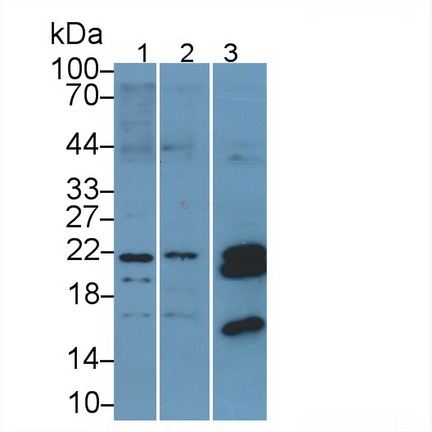 Polyclonal Antibody to Heat Shock Protein Beta 7 (HSPb7)