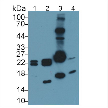 Polyclonal Antibody to Heat Shock Protein Beta 7 (HSPb7)