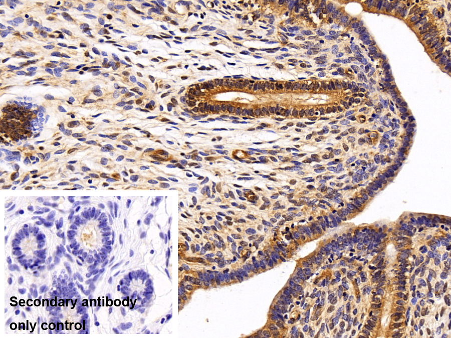 Polyclonal Antibody to Heat Shock Protein 90kDa Alpha B1 (HSP90aB1)