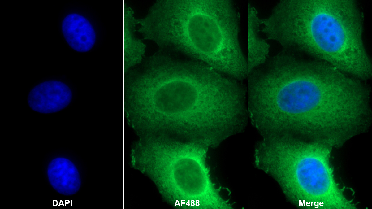 Polyclonal Antibody to Heat Shock Protein 90kDa Alpha B1 (HSP90aB1)