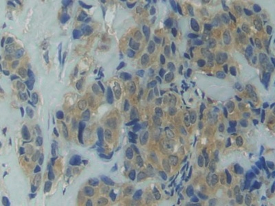 Polyclonal Antibody to Heat Shock Protein 90kDa Alpha A1 (HSP90aA1)