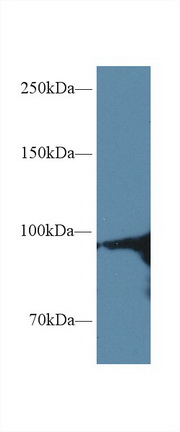 Polyclonal Antibody to Heat Shock Protein 90kDa Alpha A1 (HSP90aA1)