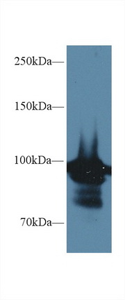 Polyclonal Antibody to Heat Shock Protein 90kDa Alpha A1 (HSP90aA1)