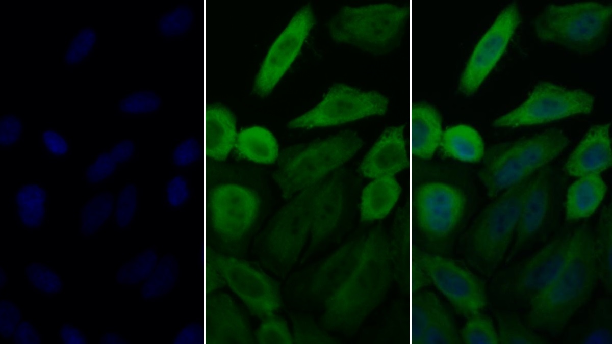 Polyclonal Antibody to Heat Shock Protein 90kDa Alpha A1 (HSP90aA1)