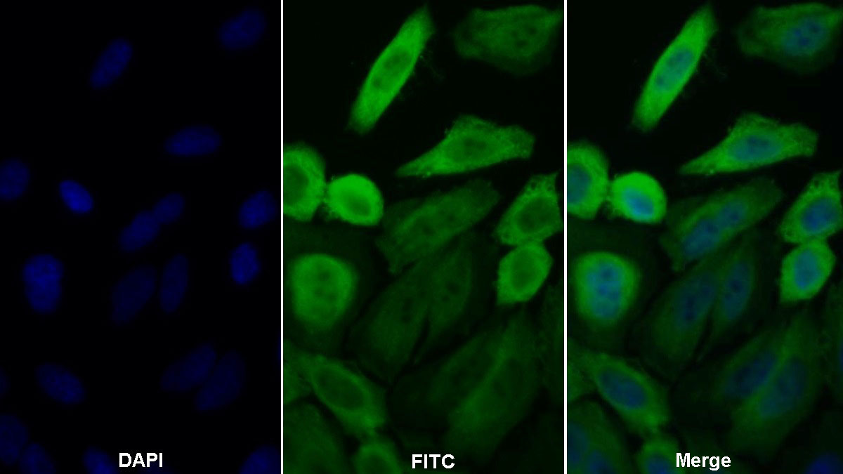 Polyclonal Antibody to Heat Shock Protein 90kDa Alpha A1 (HSP90aA1)