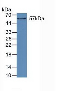 Polyclonal Antibody to Cytochrome P450 27B1 (CYP27B1)