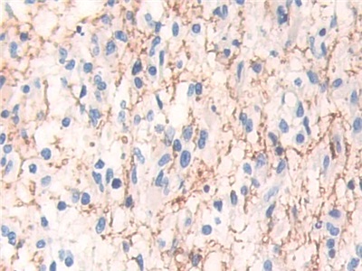 Polyclonal Antibody to Mitogen Activated Protein Kinase Kinase 1 (MAP2K1)