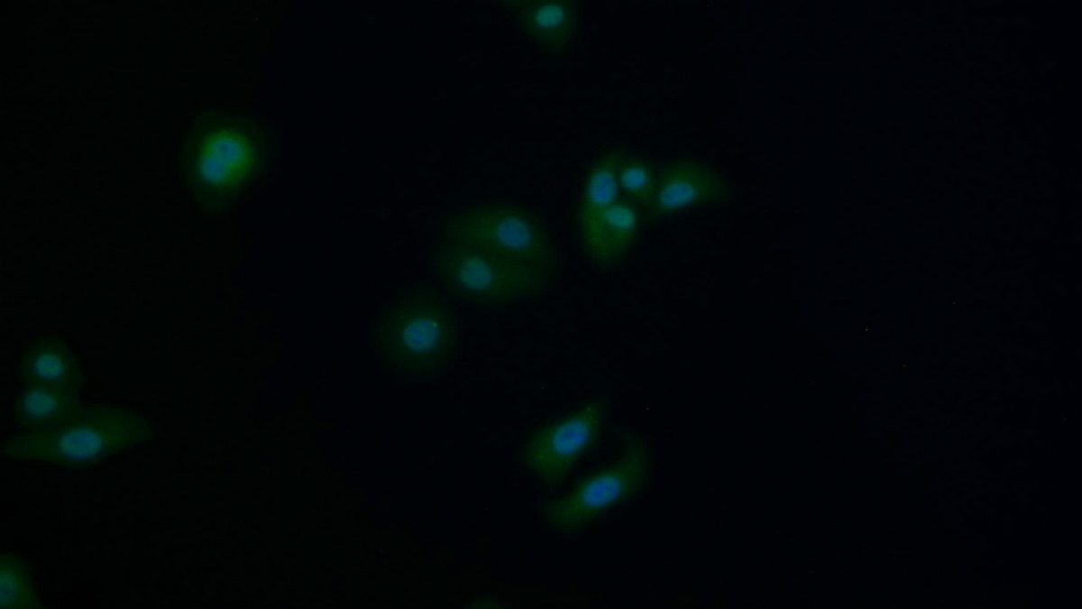 Polyclonal Antibody to Mitogen Activated Protein Kinase Kinase 1 (MAP2K1)