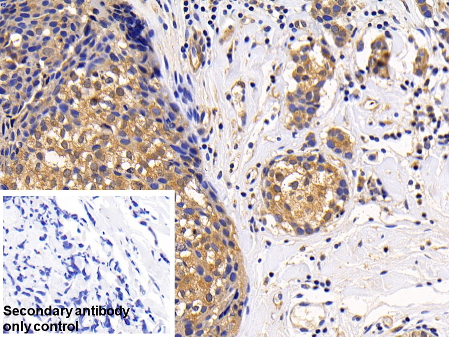 Polyclonal Antibody to Mitogen Activated Protein Kinase Kinase 1 (MAP2K1)