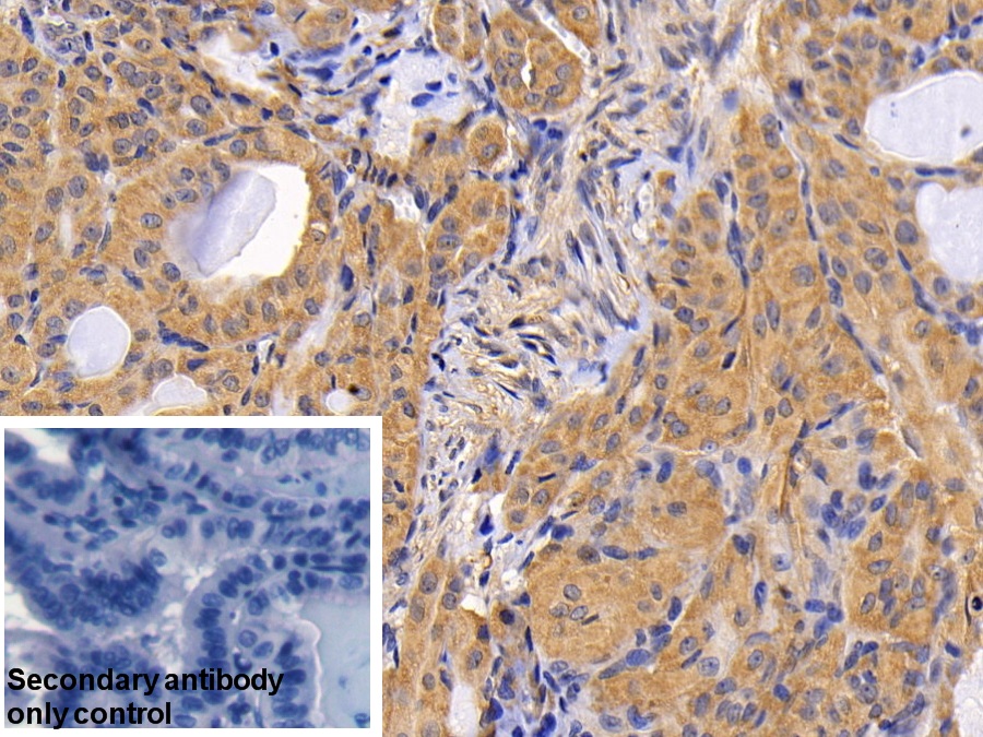 Polyclonal Antibody to Mitogen Activated Protein Kinase Kinase 1 (MAP2K1)