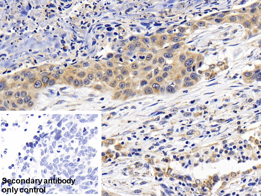 Polyclonal Antibody to Mitogen Activated Protein Kinase Kinase 1 (MAP2K1)