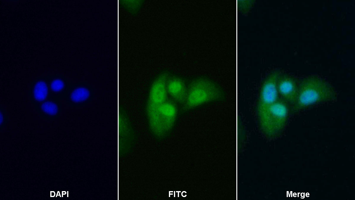 Polyclonal Antibody to Mitogen Activated Protein Kinase Kinase 1 (MAP2K1)