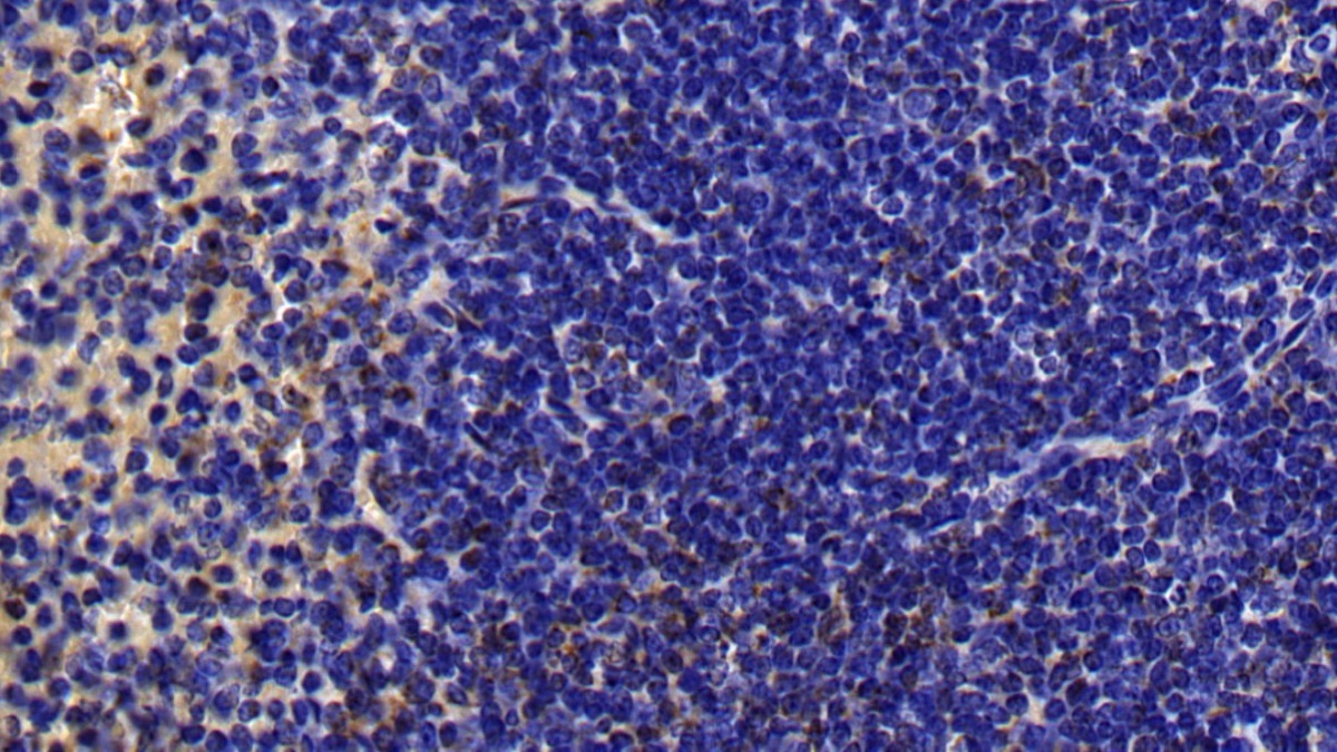 Polyclonal Antibody to Mitogen Activated Protein Kinase Kinase 7 (MAP2K7)