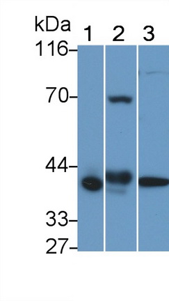 Polyclonal Antibody to Mitogen Activated Protein Kinase Kinase 3 (MAP2K3)