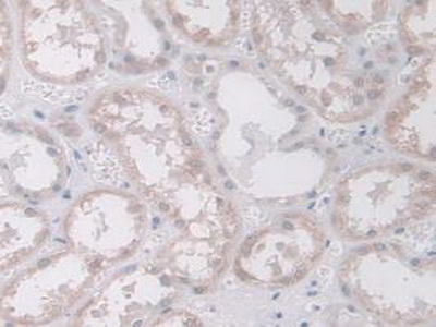 Polyclonal Antibody to Mitogen Activated Protein Kinase 12 (MAPK12)