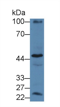 Polyclonal Antibody to Mitogen Activated Protein Kinase 12 (MAPK12)