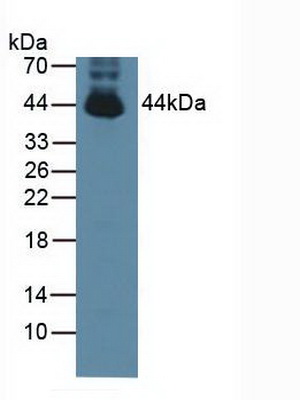 Polyclonal Antibody to Protein Tyrosine Phosphatase, Non Receptor Type 2 (PTPN2)