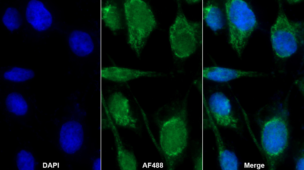 Polyclonal Antibody to Protein Tyrosine Phosphatase, Non Receptor Type 2 (PTPN2)