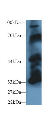 Polyclonal Antibody to Protein Tyrosine Phosphatase, Non Receptor Type 5 (PTPN5)