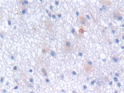 Polyclonal Antibody to Protein Tyrosine Phosphatase, Non Receptor Type 6 (PTPN6)